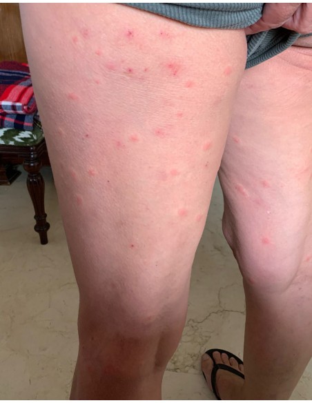 Cómo puedo eliminar los ácaros del polvo de mi hogar 【TIENDA】